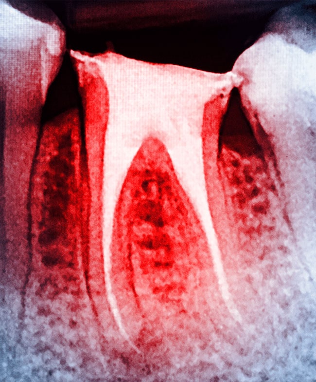 Toothache relief and emergency dental care
